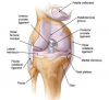 Thoái hóa khớp gối